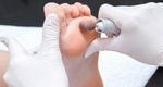 Pedicure leczniczy medyczny